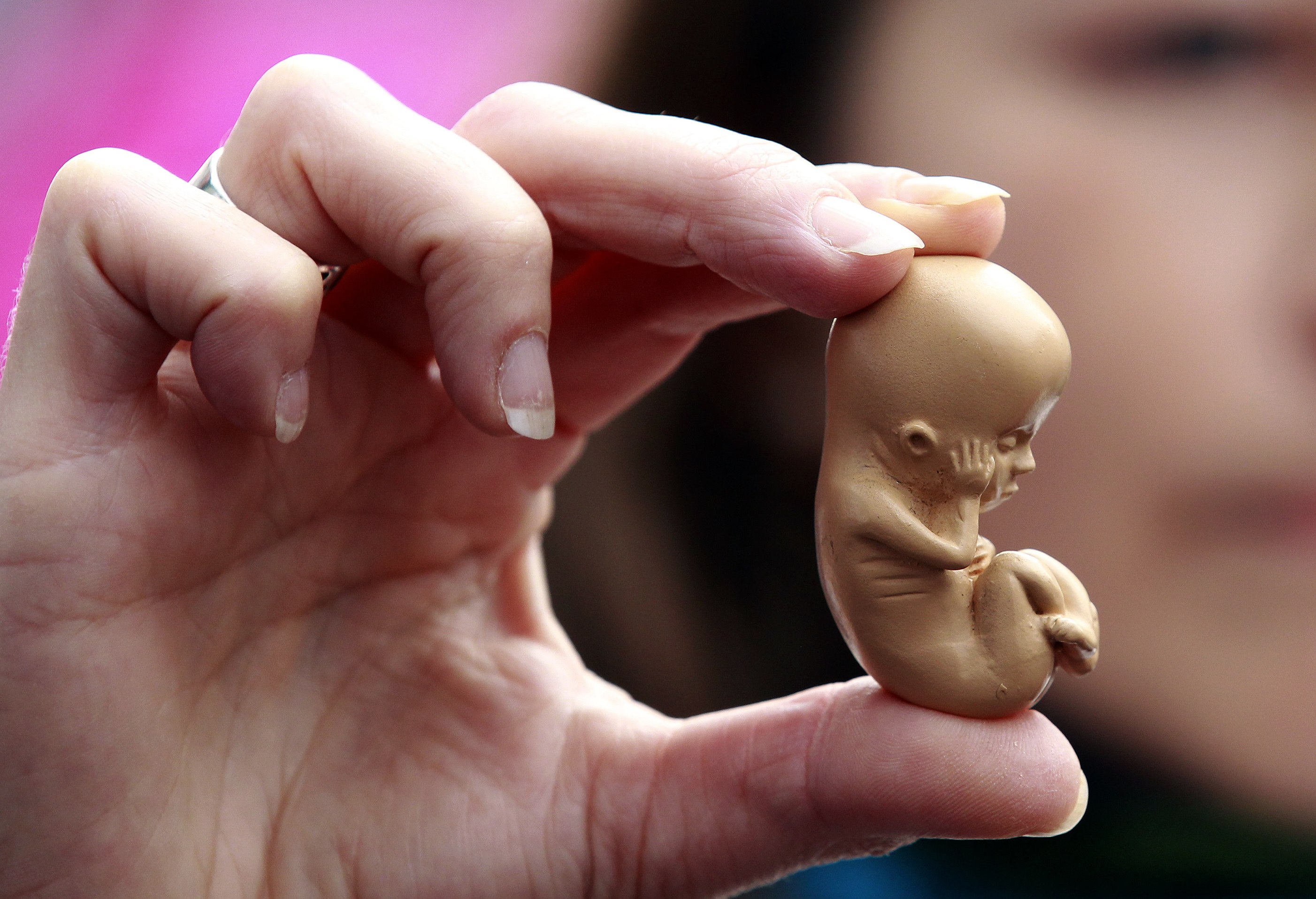 Скрещивание людей дети. Человеческий эмбрион аборт.