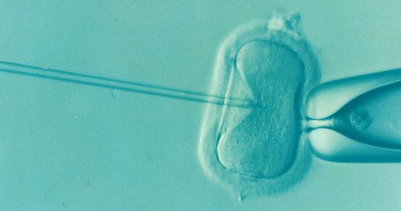 infertilidad