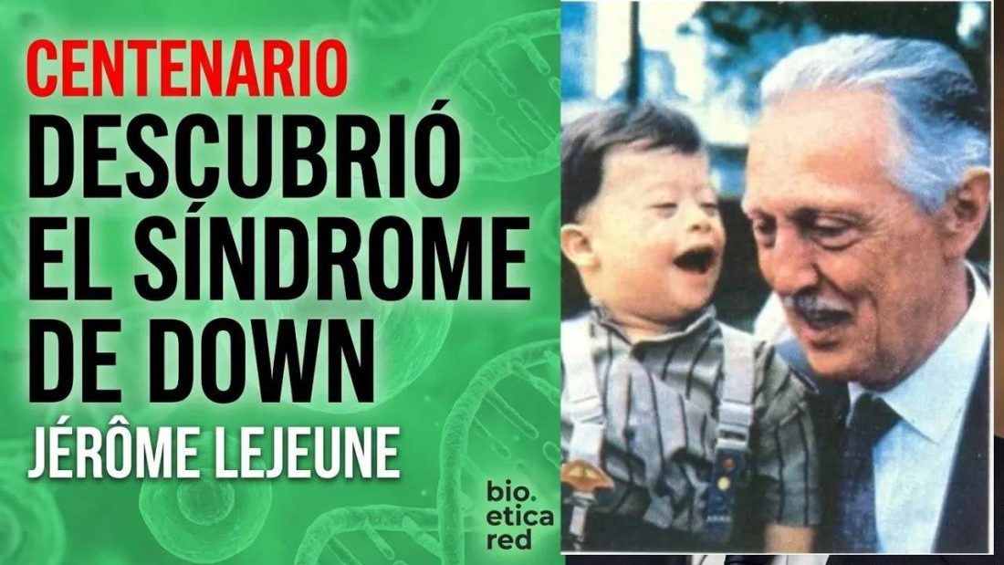 síndrome de Down