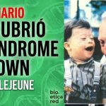 síndrome de Down