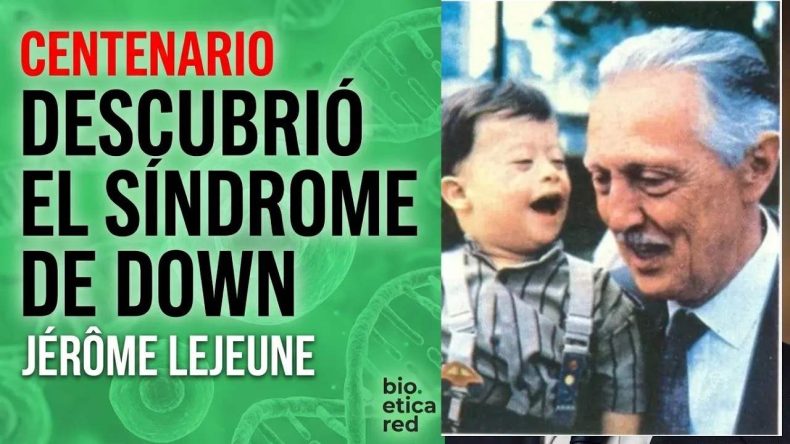 síndrome de Down